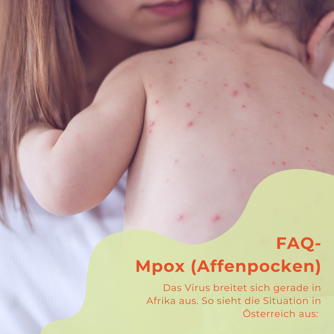 Affenpocken