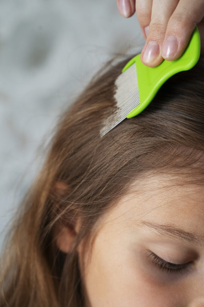 Läuse bei Kindern